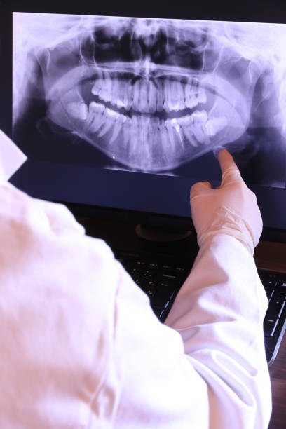 Best Emergency Treatment for Dental Infections or Abscesses in Wildwood, TN