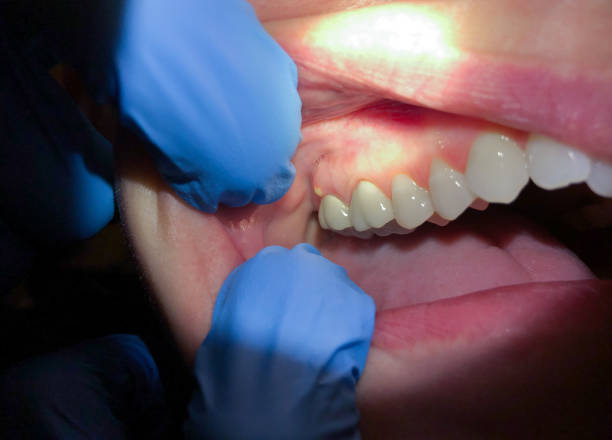 Best Emergency TMJ Treatment in Wildwood, TN